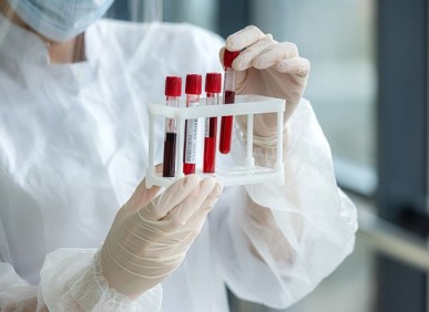 Inovações e avanços em exames de sangue